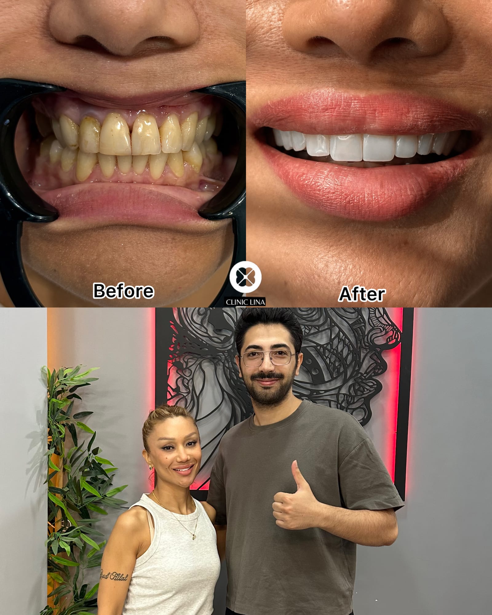 Преди